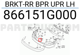 Hyundai / KIA 866151G000 BRKT-RR BPR UPR LH